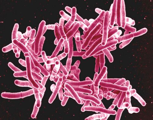 Capa do curso: Tuberculose Diagnóstico Laboral
